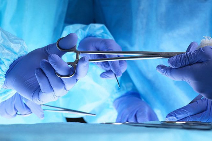 vNOTES or Laparoscopy in hysterectomy operations?