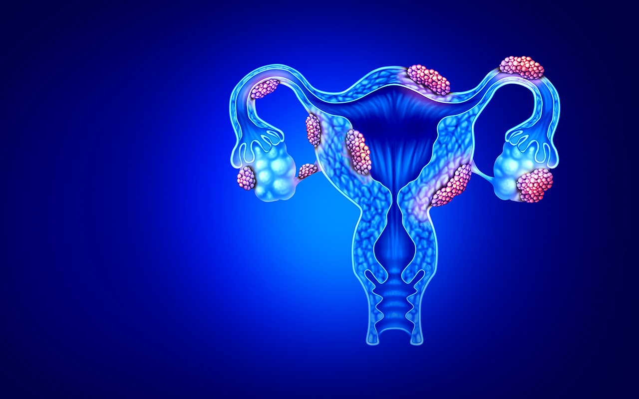 Can the severity of endometriosis be determined by blood tests?