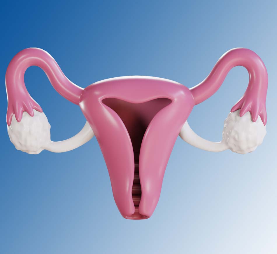 Endometriozis (Çikolata Kisti) Tedavisi